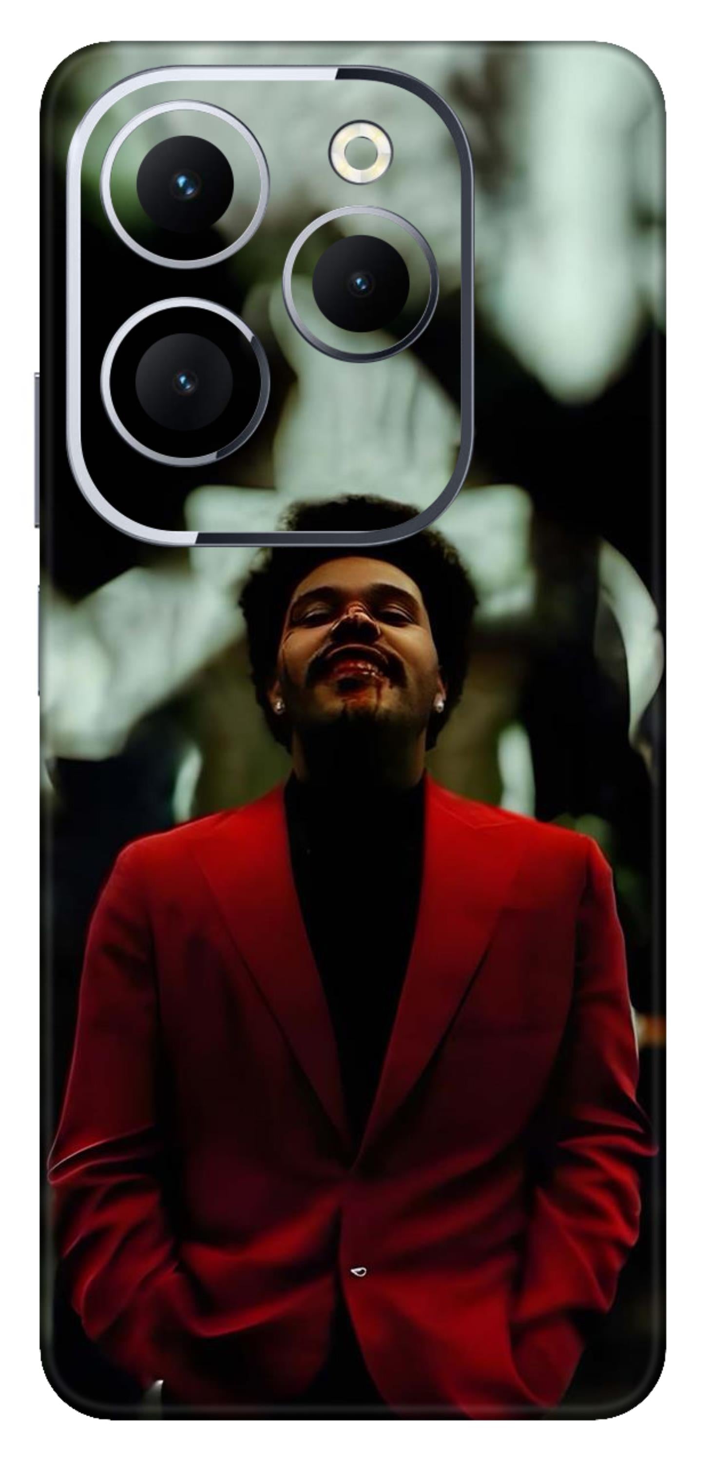 Infinix Hot 40 Skins and Wraps