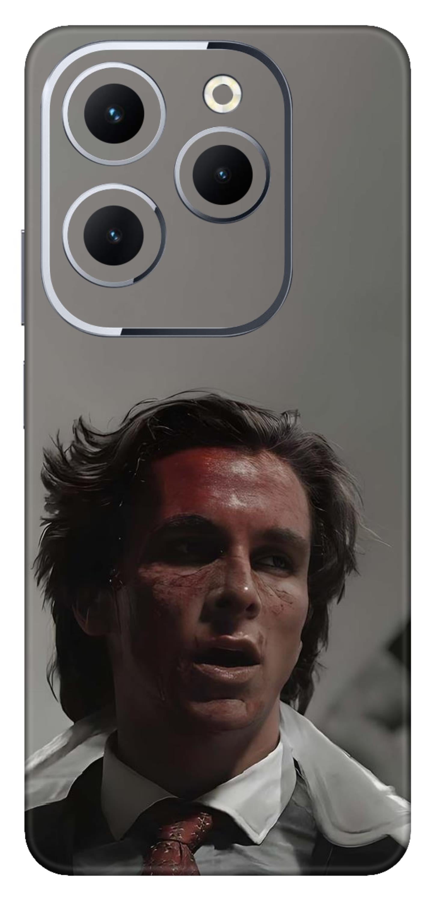 Infinix Hot 40 Skins and Wraps