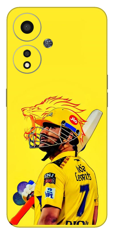 MSD