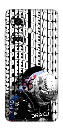 OnePlus Nord CE 3 Skins and Wraps