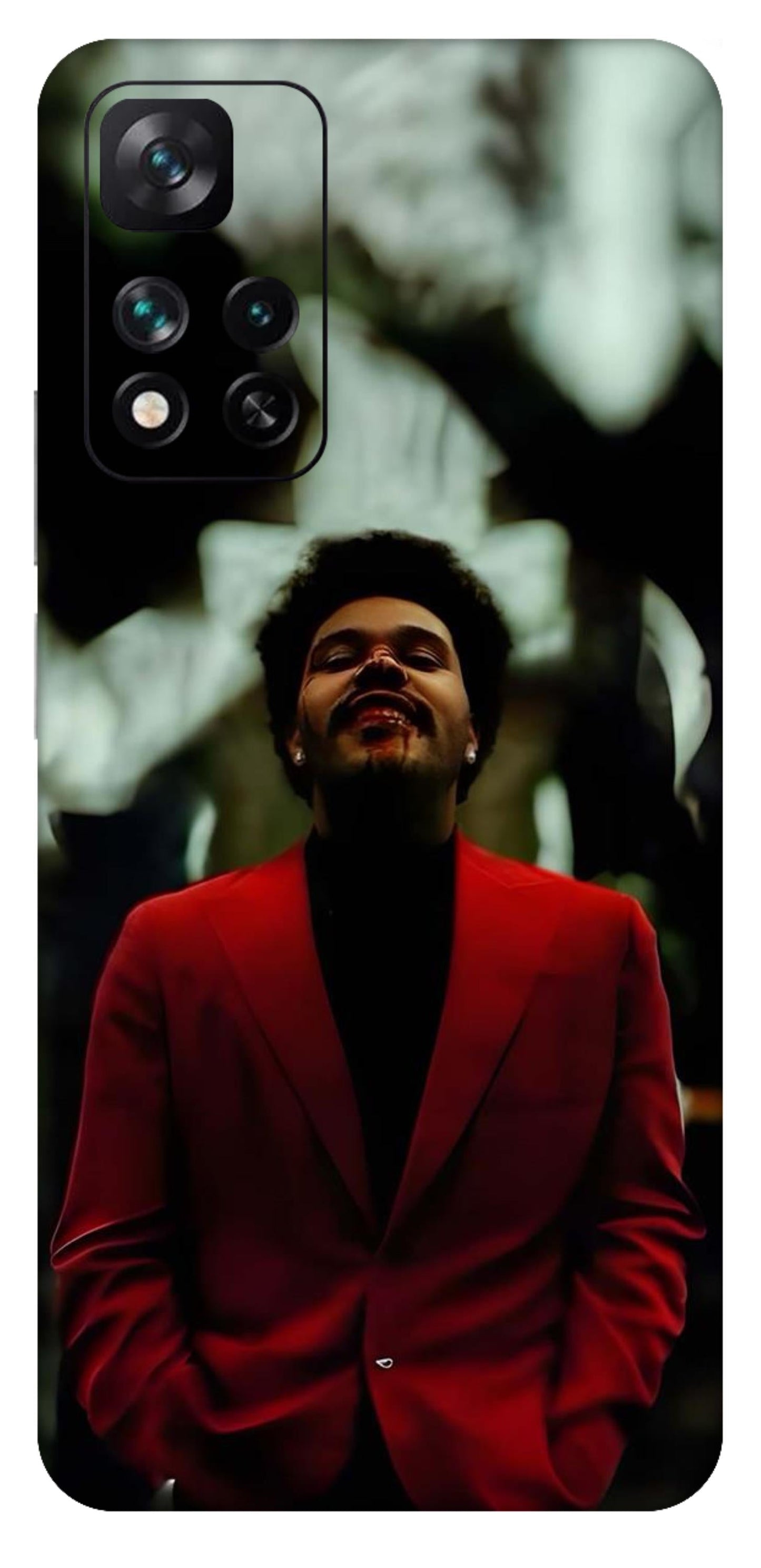 Xiaomi 11i 5G Skins and Wraps