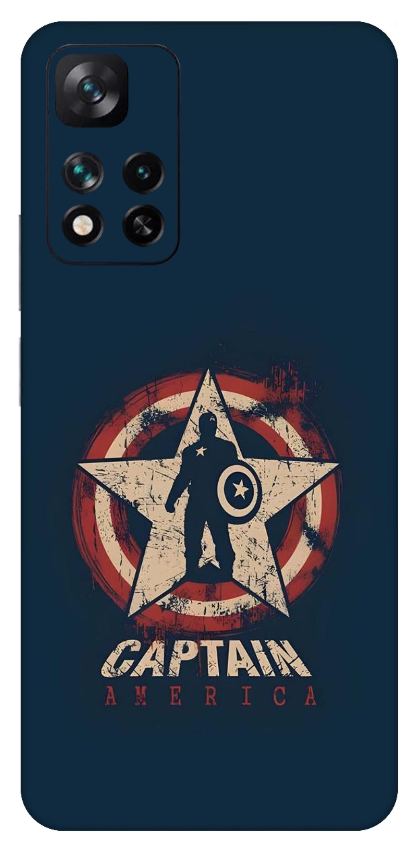 Xiaomi 11i 5G Skins and Wraps