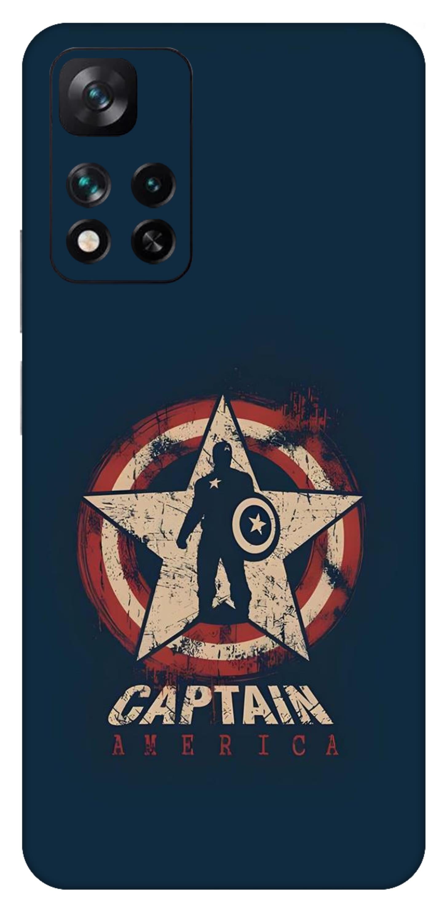 Xiaomi 11i 5G Skins and Wraps
