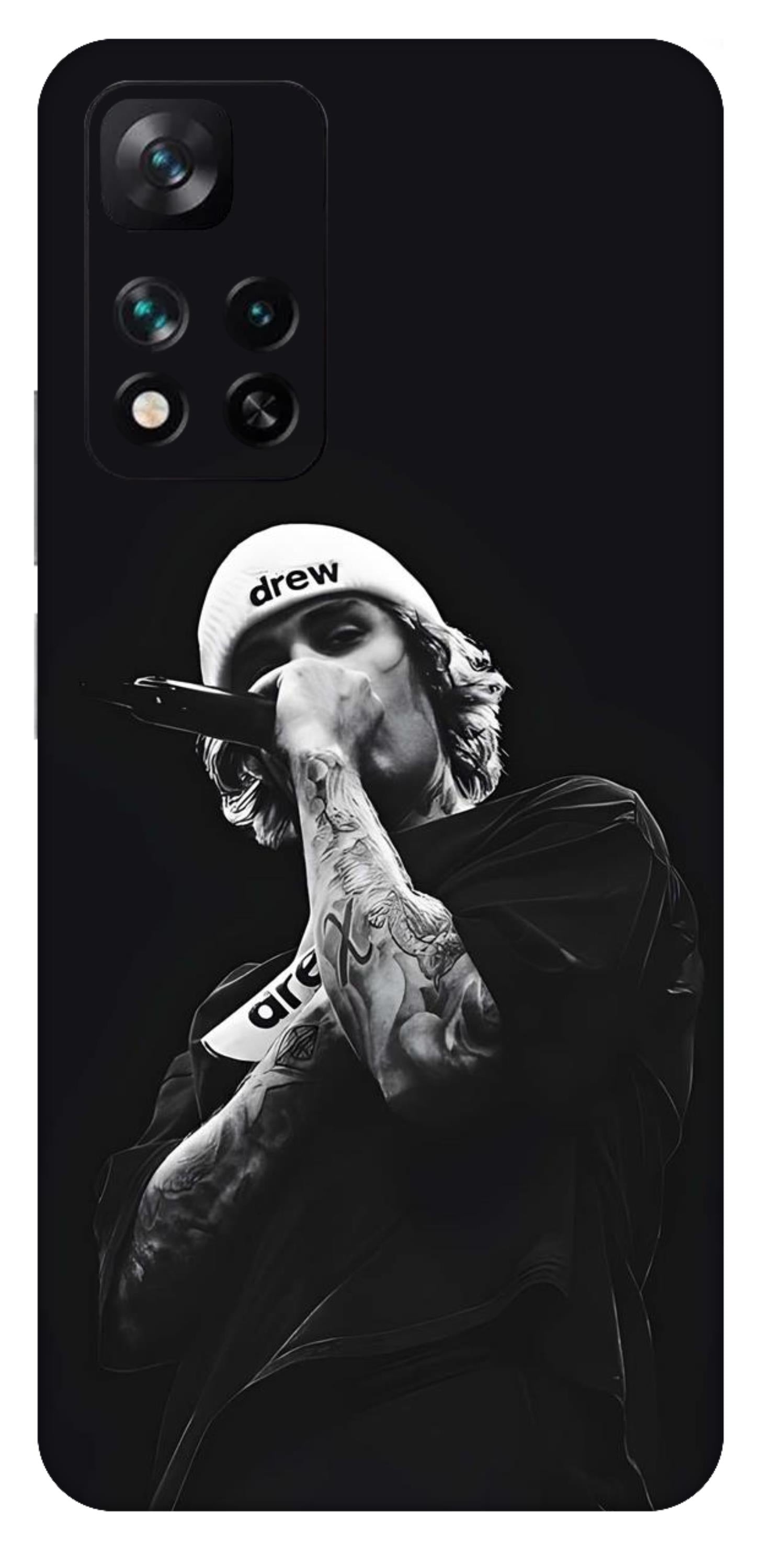 Xiaomi 11i 5G Skins and Wraps