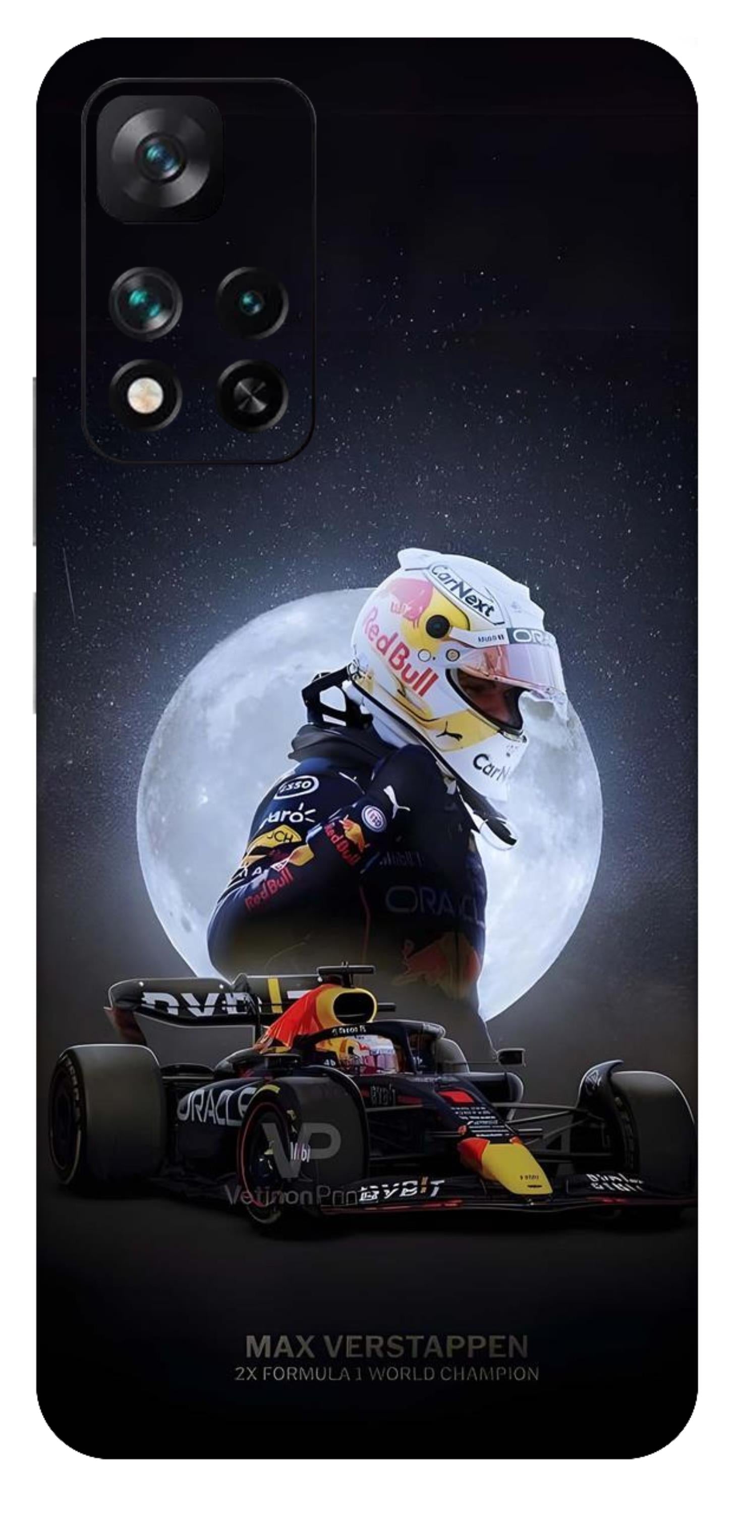Xiaomi 11i 5G Skins and Wraps