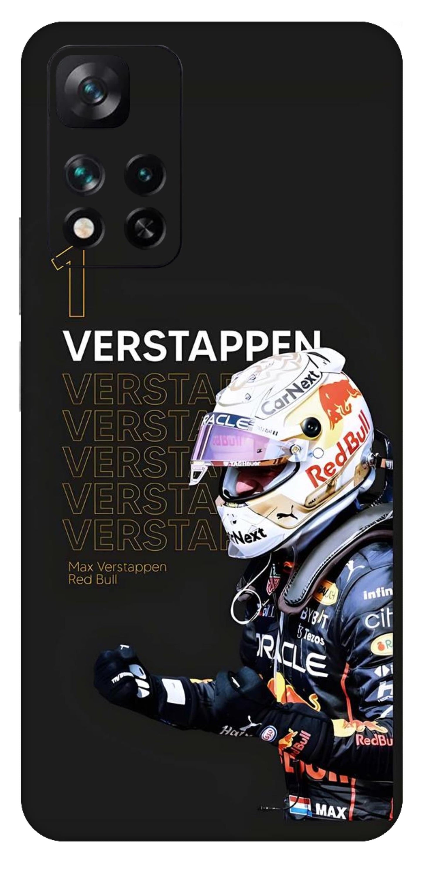 Xiaomi 11i 5G Skins and Wraps