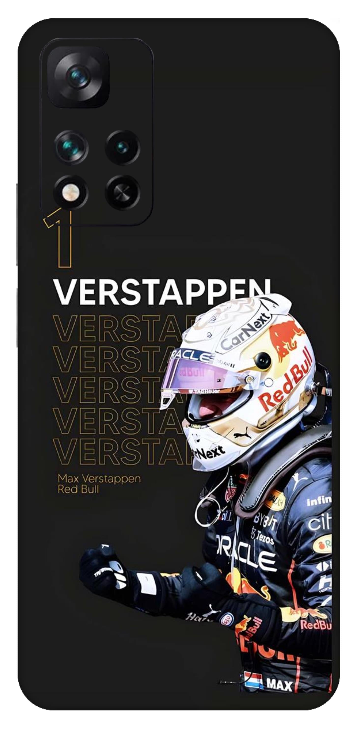 Xiaomi 11i 5G Skins and Wraps
