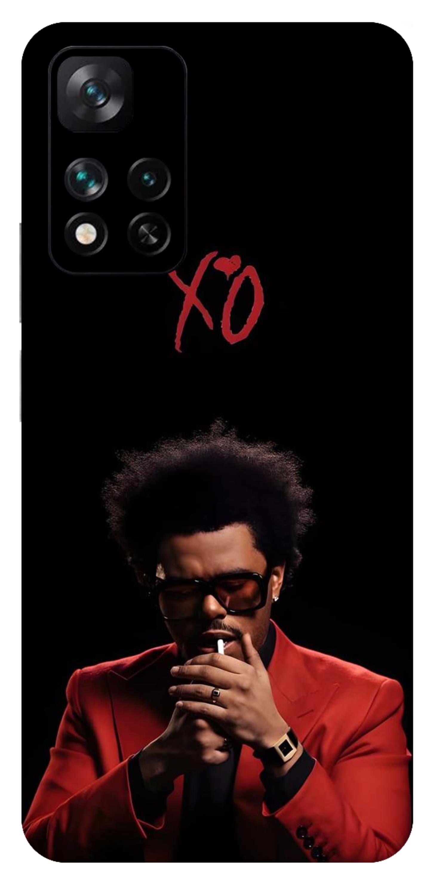 Xiaomi 11i 5G Skins and Wraps